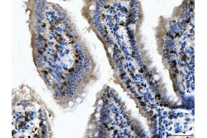 IHC analysis of CD103/Itgae using anti-CD103/Itgae antibody (ABIN7600516).