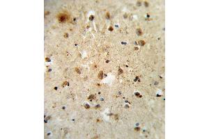 Formalin-fixed and paraffin-embedded human brain tissue reacted with ATF6 Antibody (Center), which was peroxidase-conjugated to the secondary antibody, followed by DAB staining.