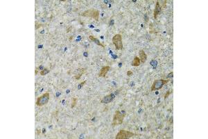 Immunohistochemistry of paraffin-embedded mouse spinal cord using TXN2 antibody.