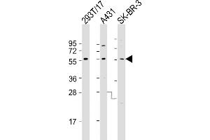 All lanes : Anti-p53 Antibody (p53-) at 1:1000-1:2000 dilution Lane 1: 293T/17 whole cell lysate Lane 2: A431 whole cell lysate Lane 3: SK-BR-3 whole cell lysate Lysates/proteins at 20 μg per lane.