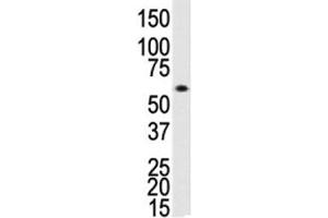 Western blot analysis of ALK3 antibody and human Saos-2 cell lysate.