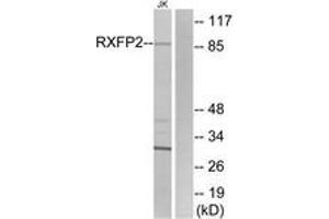 Western blot analysis of extracts from Jurkat cells, using RXFP2 Antibody. (RXFP2 anticorps  (AA 113-162))