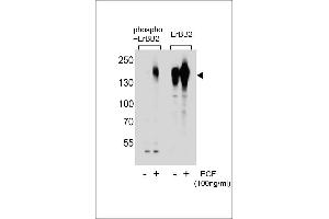 Western blot analysis of extracts from A431 cells, untreated or treated with EGF, using phospho-ERBB2- (left) or ErBB2 Antibody (right). (ErbB2/Her2 anticorps  (pSer1107))