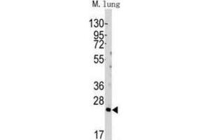 Western Blotting (WB) image for anti-BH3 Interacting Domain Death Agonist (BID) (BH3 Domain) antibody (ABIN2997129)