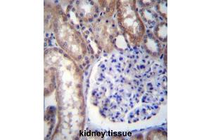 Immunohistochemistry (IHC) image for anti-Guanine Nucleotide Binding Protein (G Protein), alpha 14 (GNa14) antibody (ABIN2996930) (GNa14 anticorps)