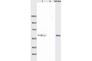 Lane 1: mouse brain lysates Lane 2: mouse heart lysates probed with Anti phospho-RPS6KB1(Ser427) Polyclonal Antibody, Unconjugated (ABIN713006) at 1:200 in 4 °C.