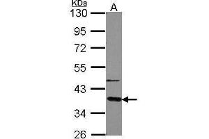 WB Image Sample (30 ug of whole cell lysate) A: A549 10% SDS PAGE antibody diluted at 1:5000 (GNAT2 anticorps  (Center))