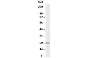 Western blot testing of PMVK antibody and rat heart tissue lysate (PMVK anticorps  (Middle Region))