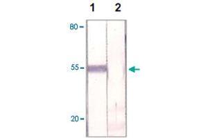 The HeLa cell lysate was immuno-blotted by FOXP1 polyclonal antibody  at 1 : 500 (Lane 1). (FOXP1 anticorps  (C-Term))