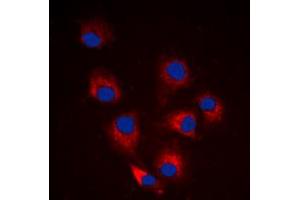 Immunofluorescent analysis of BIM (pS69) staining in HeLa cells.