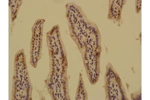 Paraformaldehyde-fixed, paraffin embedded Mouse small intestine; Antigen retrieval by boiling in sodium citrate buffer (pH6.
