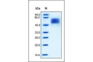 SDS-PAGE (SDS) image for Interleukin 13 Receptor, alpha 1 (IL13RA1) (AA 22-343) (Active) protein (His tag) (ABIN2181335)