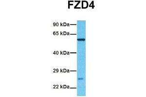 Host:  Rabbit  Target Name:  FZD4  Sample Tissue:  Human Fetal Liver  Antibody Dilution:  1. (FZD4 anticorps  (Middle Region))