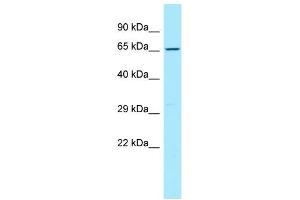 WB Suggested Anti-CD96 Antibody Titration: 1.