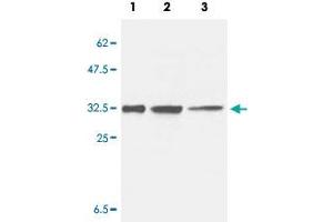 Western Blot analysis of Lane 1: HeLa, Lane 2: 293T and Lane 3: Jurkat cell lysates with CCS monoclonal antibody, clone 1G1 . (Superoxide dismutase copper chaperone anticorps)