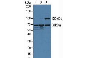 Figure. (Menin anticorps  (AA 219-395))