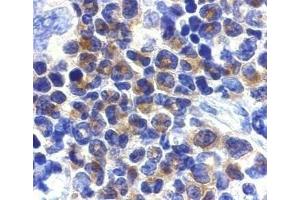 Immunohistochemical staining of DAPK2 in mouse spleen cells with DAPK2 antibody at 2μg/ml.