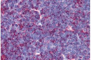 Human Thymus (formalin-fixed, paraffin-embedded) stained with MAP3K7 antibody ABIN214285 at 2.