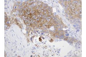 Image no. 2 for anti-CD99 (CD99) antibody (ABIN1497382)