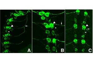 Immunofluorescence Microscopy of GFP-GOAT-Antibody. (GFP anticorps)