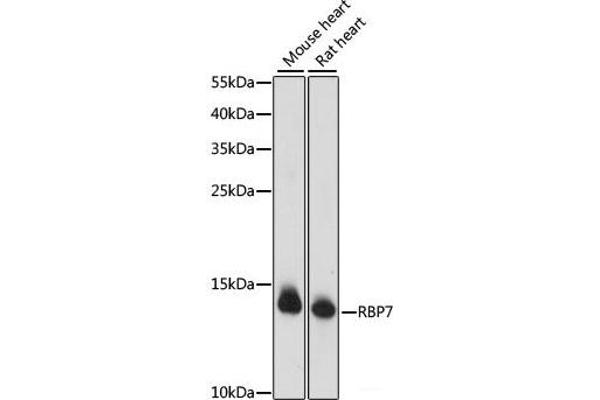 RBP7 抗体