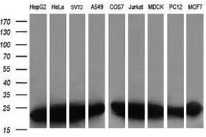 Image no. 6 for anti-Prefoldin Subunit 3 (PFDN3) antibody (ABIN1501701) (VBP1 anticorps)