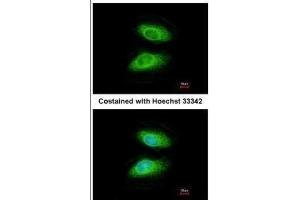 ICC/IF Image Immunofluorescence analysis of methanol-fixed HeLa, using IRAK2, antibody at 1:200 dilution. (IRAK2 anticorps)