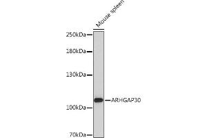Western blot analysis of extracts of Mouse spleen, using  Rabbit pAb (ABIN7269965) at 1:1000 dilution. (ARHGAP30 anticorps  (AA 485-585))