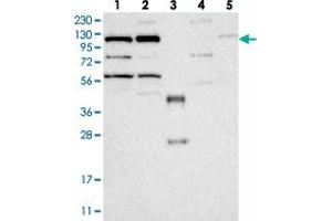 Western blot analysis of Lane 1: RT-4, Lane 2: U-251 MG, Lane 3: Human Plasma, Lane 4: Liver, Lane 5: Tonsil with KIF5C polyclonal antibody  at 1:250-1:500 dilution. (KIF5C anticorps)