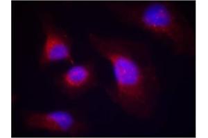 Image no. 2 for anti-Spleen tyrosine Kinase (SYK) (pTyr323) antibody (ABIN319292) (SYK anticorps  (pTyr323))