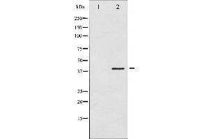 Western blot analysis of hnRNP C1/2 phosphorylation expression in H2O2 treated 293 whole cell lysates,The lane on the left is treated with the antigen-specific peptide.