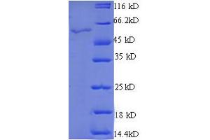 SDS-PAGE (SDS) image for StAR-Related Lipid Transfer (START) Domain Containing 7 (STARD7) (AA 61-307), (partial) protein (GST tag) (ABIN5712289) (STARD7 Protein (AA 61-307, partial) (GST tag))