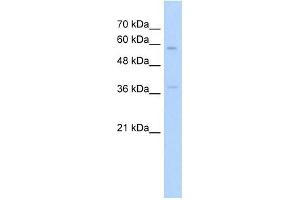 ITGBL1 antibody used at 5 ug/ml to detect target protein. (ITGBL1 anticorps)