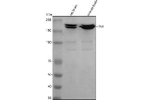 Western blot analysis of Tenascin-R/TNR using anti-Tenascin-R/TNR antibody (ABIN7602144).
