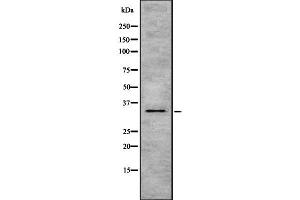 Western blot analysis of HSD17B1 using MCF7 whole  lysates. (HSD17B1 anticorps  (C-Term))