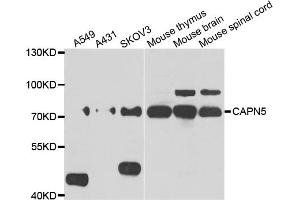 Western blot analysis of extracts of various cell lines, using CAPN5 antibody (ABIN5975527) at 1/1000 dilution. (Calpain 5 anticorps)