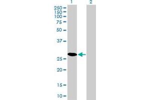 Western Blot analysis of CDK4 expression in transfected 293T cell line by CDK4 monoclonal antibody (M03), clone 4F11.