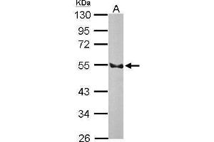 WB Image Sample (50 ug of whole cell lysate) A: Rat brain 10% SDS PAGE antibody diluted at 1:3000