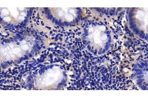 Detection of CNN1 in Human Appendix Tissue using Polyclonal Antibody to Calponin 1, Basic (CNN1) (CNN1 anticorps  (AA 1-268))
