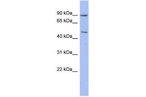 WB Suggested Anti-ZNF569 Antibody Titration:  0. (ZNF569 anticorps  (N-Term))