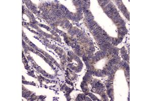 IHC analysis of BRD7 using anti-BRD7 antibody .