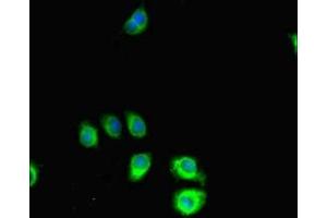 Immunofluorescent analysis of A549 cells using ABIN7169823 at dilution of 1:100 and Alexa Fluor 488-congugated AffiniPure Goat Anti-Rabbit IgG(H+L) (SLIT-ROBO rho GTPase Activating Protein 2C (SRGAP2C) (AA 1-242) anticorps)