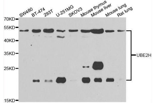 UBE2H Antikörper  (AA 1-183)