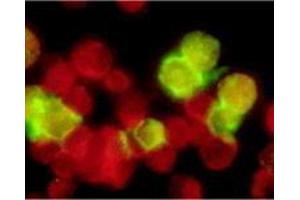 Immunofluorescence (IF) image for anti-Epstein-Barr Virus Membrane Antigen gp350 (EBV gp350) antibody (ABIN265550) (EBV-Gp350 anticorps)