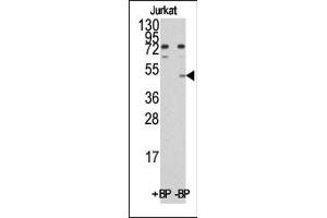Western blot analysis of anti-MINA (C-term) Pab pre-incubated with and without blocking peptide (BP)(catlog :BP1033b) in Jurkat cell line lysate. (MINA anticorps  (C-Term))