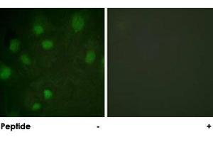 Immunofluorescence analysis of HeLa cells, using IGF2R polyclonal antibody . (IGF2R anticorps)