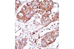 Image no. 2 for anti-Bone Morphogenetic Protein Receptor 1A (BMPR1A) (Middle Region) antibody (ABIN357375) (BMPR1A anticorps  (Middle Region))