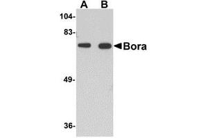 Western blot analysis of Bora in mouse brain tissue lysate with AP30161PU-N Bora antibody at (A) 1 and (B) 2 μg/ml.