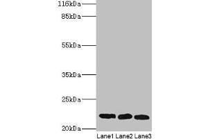 Western blot All lanes: SSSCA1 antibody at 2 μg/mL Lane 1: A549 whole cell lysate Lane 2: MCF-7 whole cell lysate Lane 3: 293T whole cell lysate Secondary Goat polyclonal to rabbit IgG at 1/10000 dilution Predicted band size: 22 kDa Observed band size: 22 kDa (SSSCA1 anticorps  (AA 2-199))