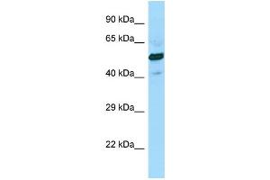 WB Suggested Anti-SUCLG2 Antibody Titration: 1. (SUCLG2 anticorps  (C-Term))